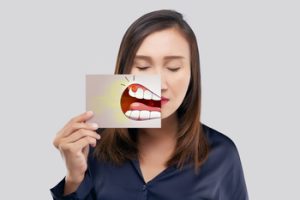 duration of tooth abscess take to heal adelaide