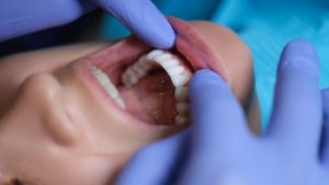 tooth abscess pain spreading consult