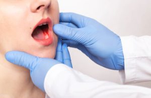 Types Of Dental Abscess pain