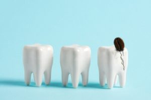 How Long Can a Broken Tooth Go Untreated fracture